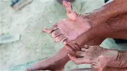 ##IMAGE##