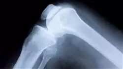 ##IMAGE##