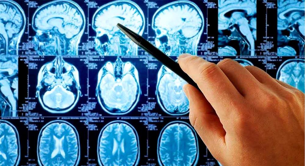 especializacion online intervención fisioterápico del daño cerebral adquirido para el médico rehabilitador