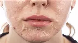 ##IMAGE##