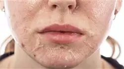 ##IMAGE##