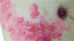 ##IMAGE##