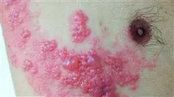 ##IMAGE##