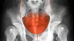 ##IMAGE##