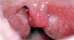 formacion microbiota oral y respiratoria