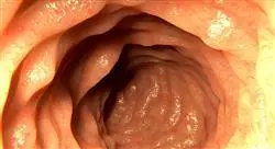 posgrado microbiota y homeostasis intestinal