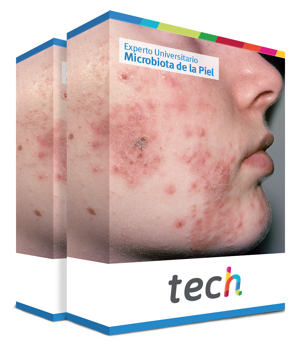 especializacion microbiota piel caja