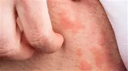 ##IMAGE##
