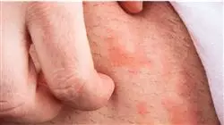 ##IMAGE##