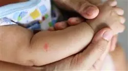 ##IMAGE##