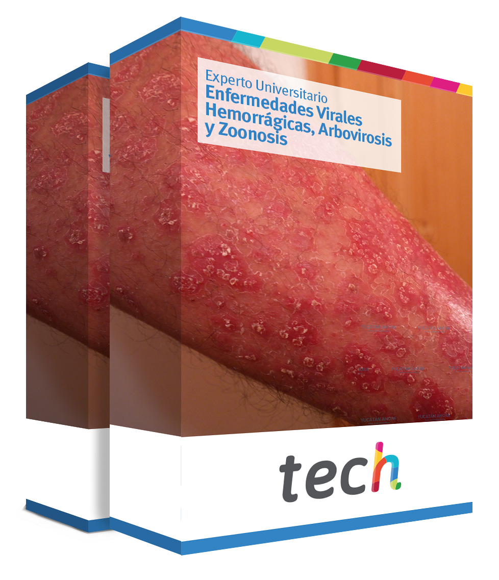 especializacion enfermedades virales hemorragicas arbovirosis zoonosis caja