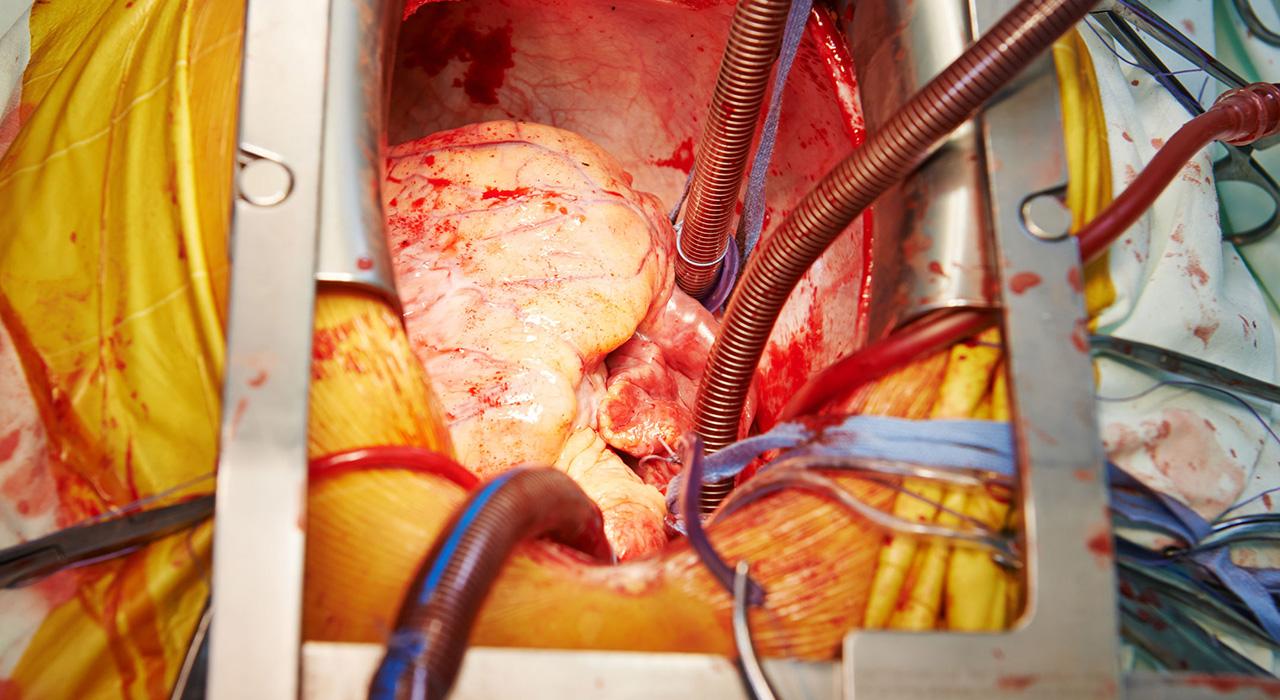 amaster cardio oncologia portada Tech Universidad