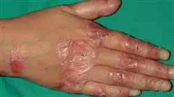 ##IMAGE##