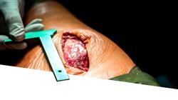 maestria enfermedades infecciosas