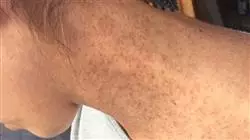 ##IMAGE##