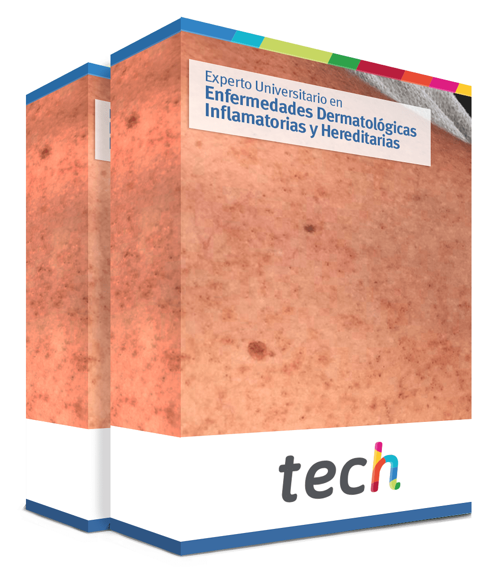 especializacion enfermedades dermatologicas inflamatorias hereditarias caja