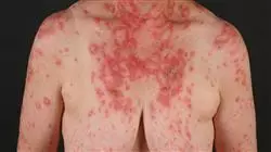 ##IMAGE##