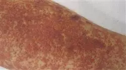 ##IMAGE##