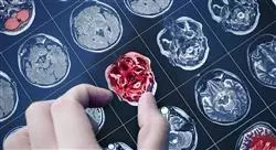 estudiar alzheimer deterioro cognitivo vascular y cuerpos de lewy