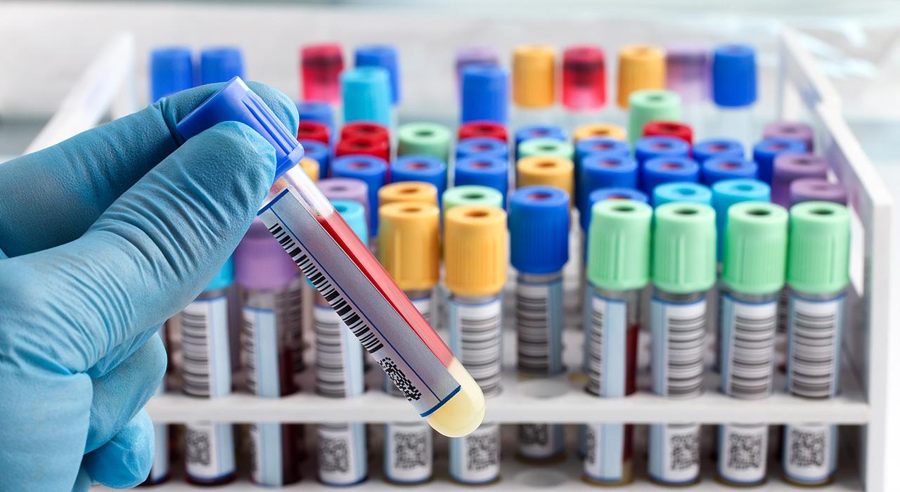 experto biotecnologia ambito analisis clinicos 1 Tech Universidad