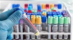 especialización biotecnología en el ámbito de los análisis clínicos