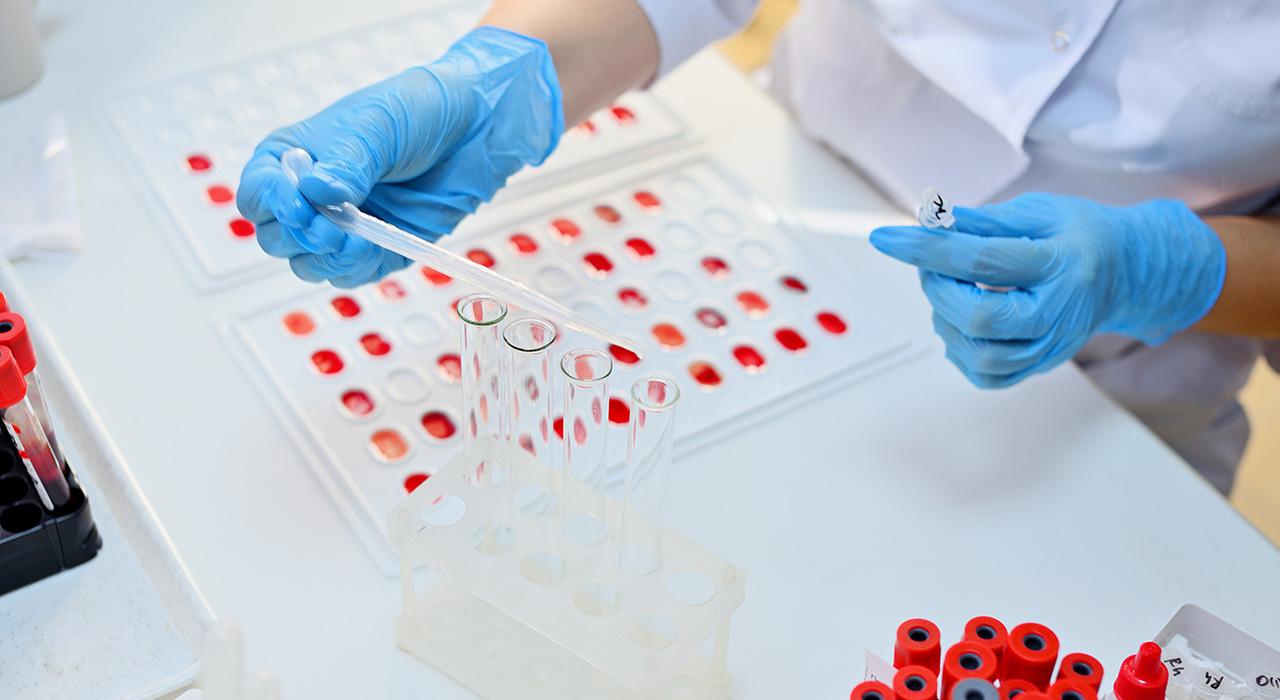 curso bioquimica analisis clinicos ll 1 Tech Universidad