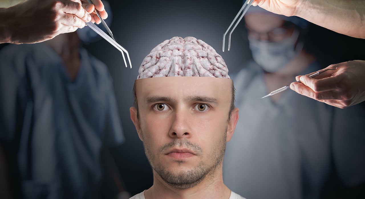 Хирургическая операция на головном мозге