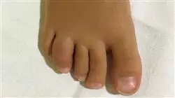 ##IMAGE##