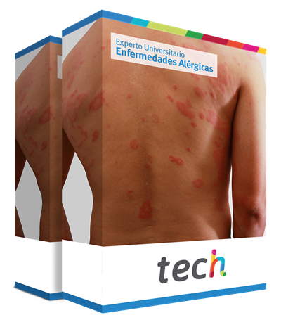 especializacion enfermedades alergicas caja