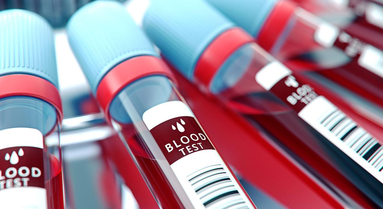 experto avances anemias trastornos medulares fisiologia hemostasia antihemorragicos 2 Tech Universidad