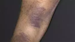 ##IMAGE##