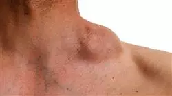 ##IMAGE##