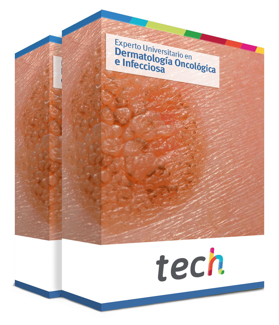 especializacion dermatologia oncologica infecciosa caja
