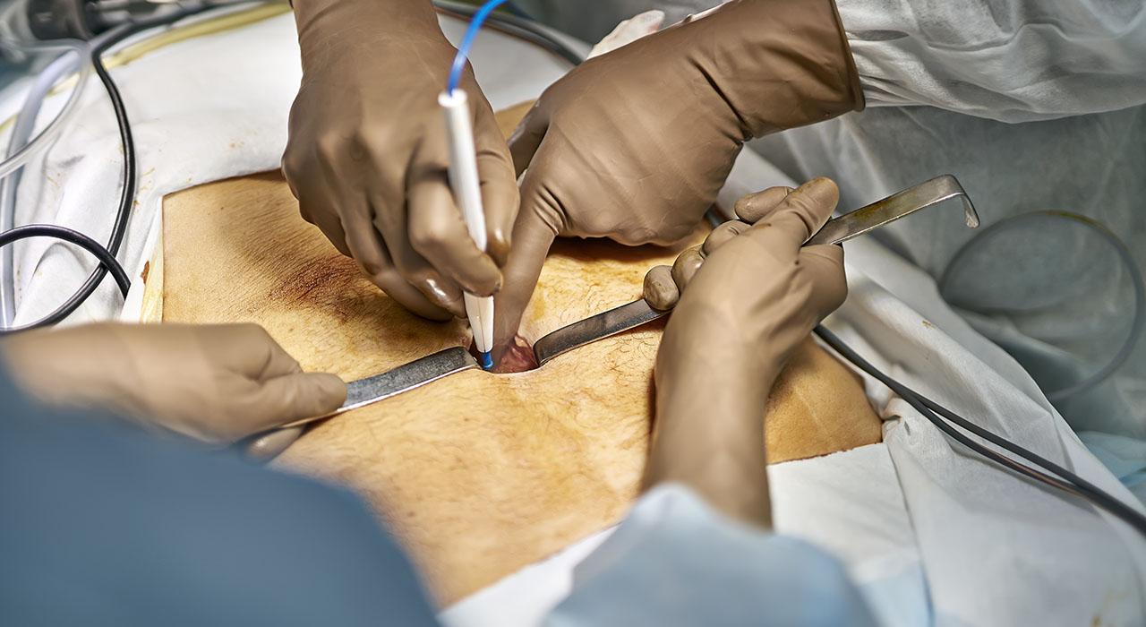 experto laparoscopia cirugia general cirugia abdominal cirugia neonatal fetal 1 Tech Universidad