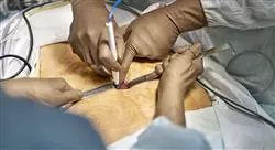 experto universitario laparoscopia en cirugía general cirugía abdominal y cirugía neonatal y fetal