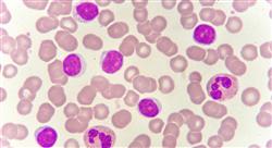 formacion actualización en medicina transfusional y el trasplante de células hematopoyéticas