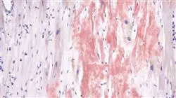 ##IMAGE##