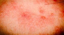 master dermatología