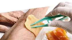 ##IMAGE##