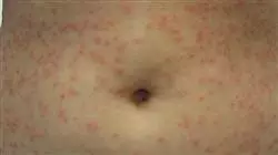 ##IMAGE##