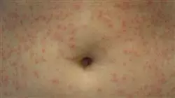 ##IMAGE##