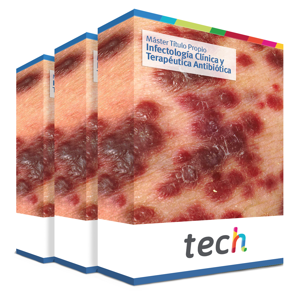 maestria infectologia clinica terapeutica antibiotica caja