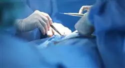 curso laparoscopia oncológica y gonadal en pediatría