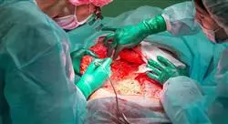 curso online cirugía abdominal a través de puerto único y cirugía robótica en pediatría