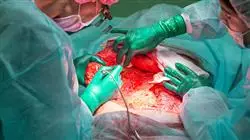 diplomado online cirugia abdominal traves puerto unico cirugia robotica pediatria