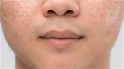 ##IMAGE##