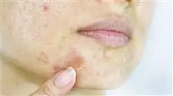 ##IMAGE##