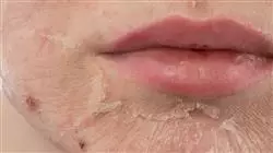 ##IMAGE##