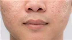 ##IMAGE##