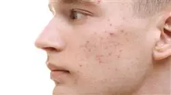 ##IMAGE##